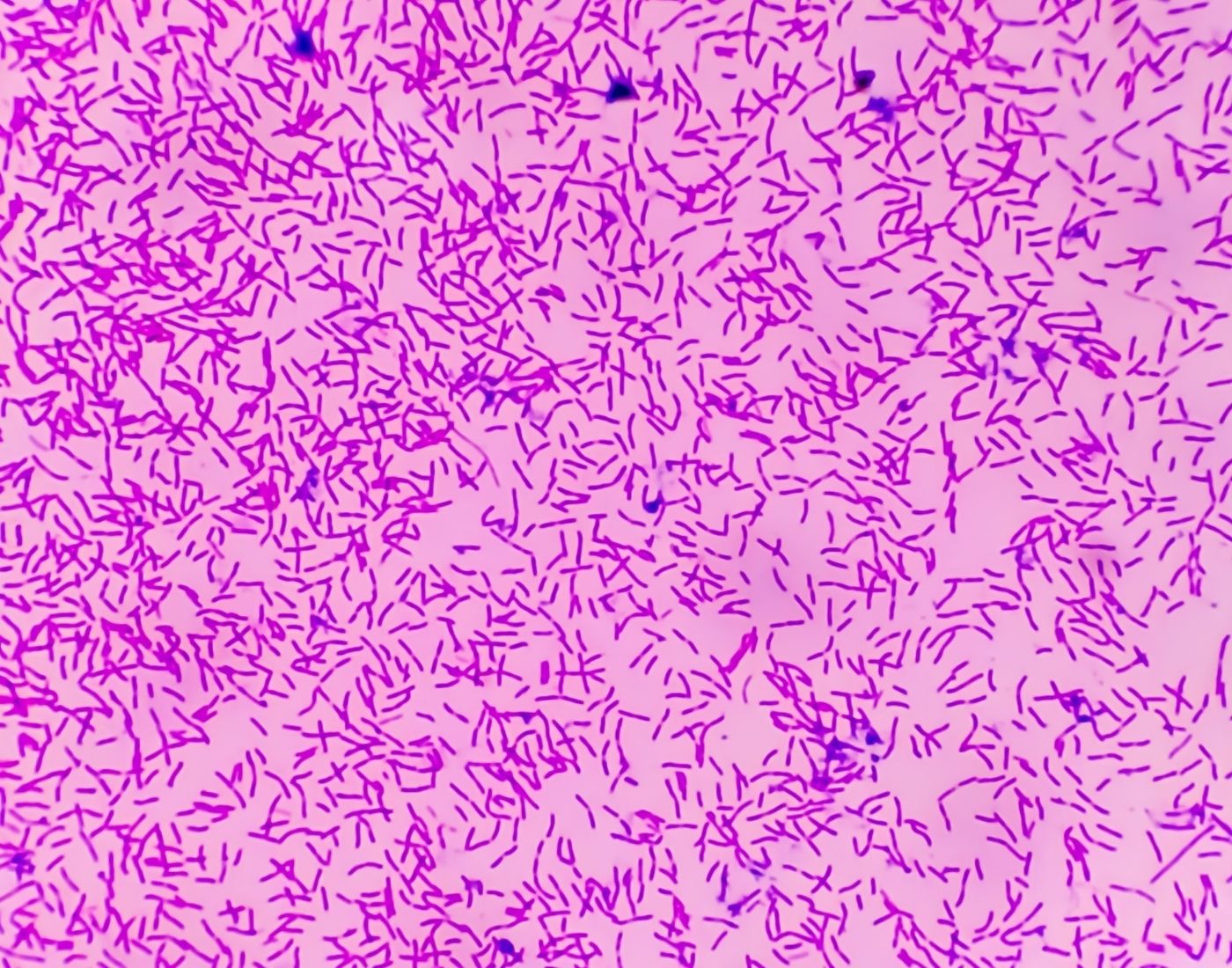 Close up of e.coli food poisoning bacteria