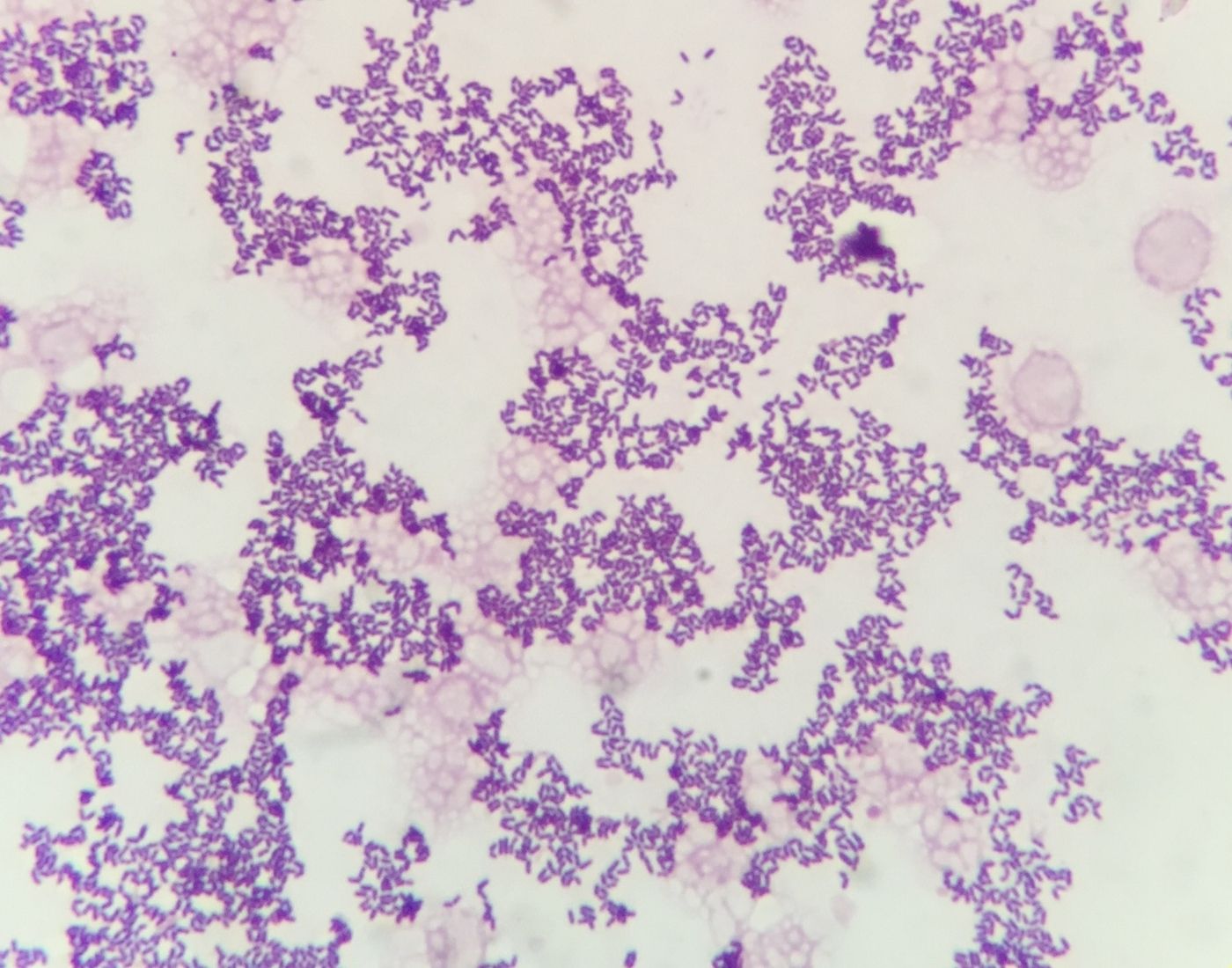 Listeria bacteria. They're v shaped and purple on a white background.