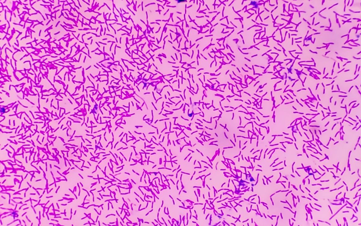 Purple bacteria under a microscope.