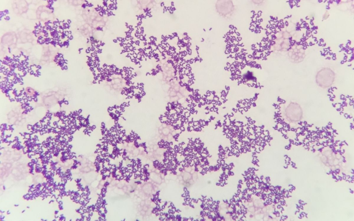 Microscopic image showing clusters of purple-stained cells on a pale pink background.