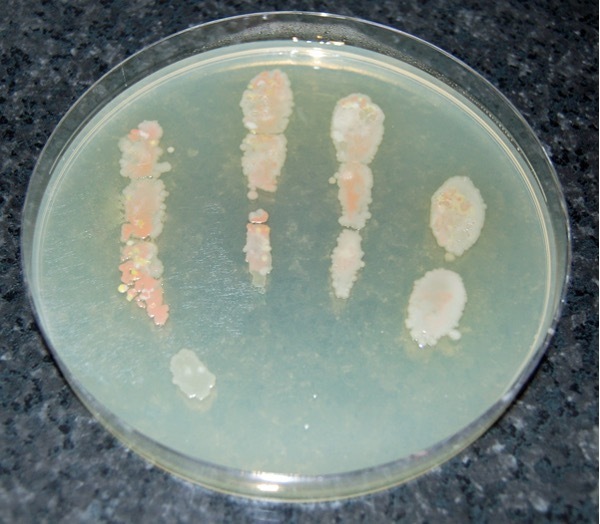 Microorganisms on the fingers of an unwashed hand