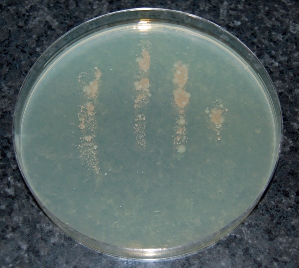 Few microorganisms on the fingers of a hand washed in soapy water and sanitised using an alcohol gel