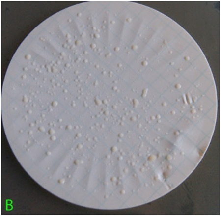 A set of typical incubated water filter membranes from a fast-flowing overland river after treatment (B)