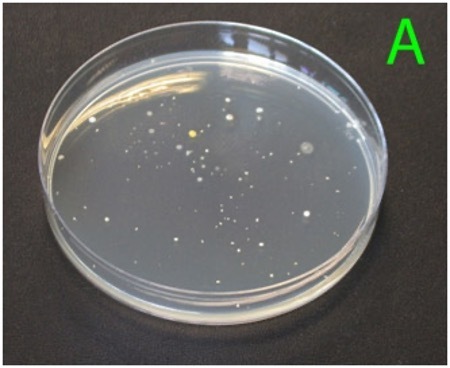 Petri dish showing the range of different bacterial colonies after incubation of a highly diluted sample (1:1,000,000).